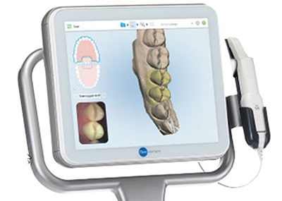 Itero®-Element™ Scanner Digitale Kieferorthopädie Teja Will, Essen