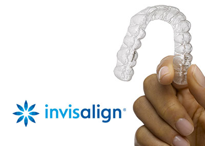 Invisalign · Fast unsichtbar Aligner-Zahnspangen